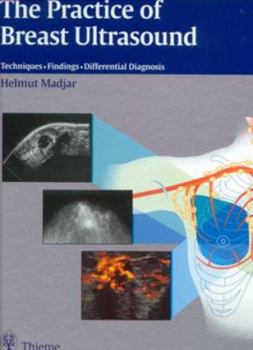 Hardcover The Practice of Breast Ultrasound: Techniques, Findings, Differential Diagnosis Book