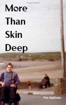 Paperback More Than Skin Deep Book
