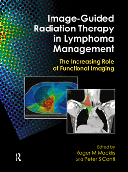 Hardcover Image-Guided Radiation Therapy in Lymphoma Management: The Increasing Role of Functional Imaging Book