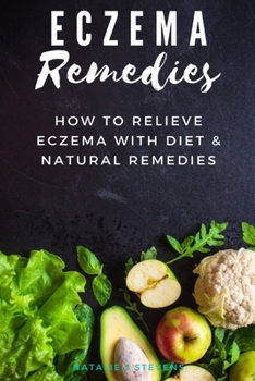 Paperback Eczema Remedies: How to Relieve Eczema With Diet & Natural Remedies Book
