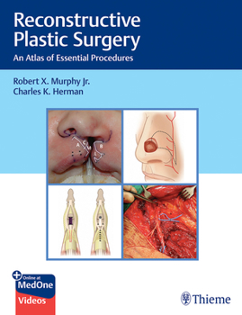Hardcover Reconstructive Plastic Surgery: An Atlas of Essential Procedures Book