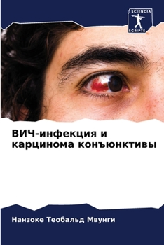 Paperback &#1042;&#1048;&#1063;-&#1080;&#1085;&#1092;&#1077;&#1082;&#1094;&#1080;&#1103; &#1080; &#1082;&#1072;&#1088;&#1094;&#1080;&#1085;&#1086;&#1084;&#1072; [Russian] Book