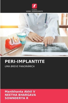 Paperback Peri-Implantite [Portuguese] Book