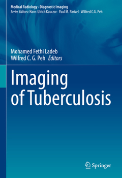 Hardcover Imaging of Tuberculosis Book