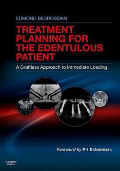 Hardcover Implant Treatment Planning for the Edentulous Patient: A Graftless Approach to Immediate Loading Book