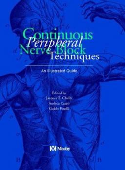 Hardcover Continuous Peripheral Nerve Blocks: An Illustrated Guide Book
