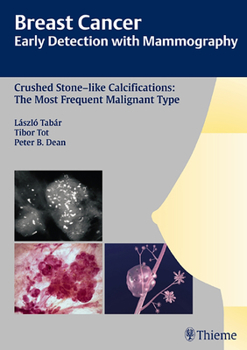 Hardcover Breast Cancer: Early Detection with Mammography: Crushed Stone-Like Calcifications: The Most Frequent Malignant Type [With CDROM] Book
