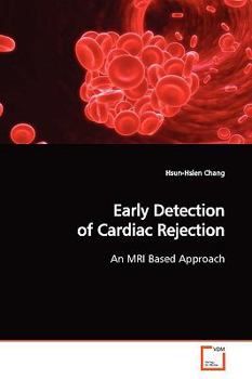 Paperback Early Detection of Cardiac Rejection Book