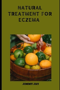 Paperback Natural Treatment For Eczema: Diets For Healthy Living [Large Print] Book