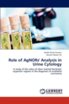 Role of AgNORs' Analysis in Urine Cytology: A study of the value of silver stained Nucleolar organizer regions in the diagnosis of urothelial carcinoma