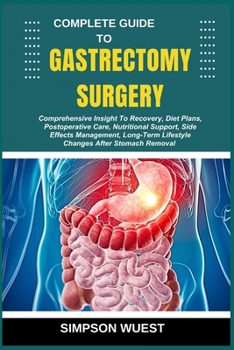 Paperback Complete Guide to Gastrectomy Surgery: Comprehensive Insight To Recovery, Diet Plans, Postoperative Care, Nutritional Support, Side Effects Management Book
