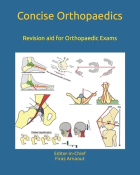 Paperback Concise Orthopaedic Notes: Revision aid for FRCS, EBOT , SICOT and Board Examinations Book