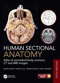 Human Sectional Anatomy: Atlas of Body Sections, CT and MRI Images