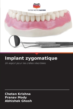 Paperback Implant zygomatique [French] Book