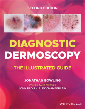 Paperback Diagnostic Dermoscopy: The Illustrated Guide Book