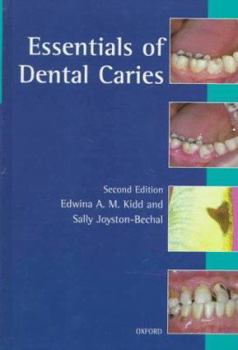 Paperback Essentials of Dental Caries: The Disease and Its Management Book