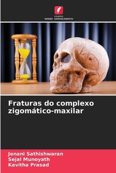 Paperback Fraturas do complexo zigomático-maxilar [Portuguese] Book