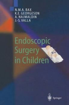 Paperback Endoscopic Surgery in Children Book