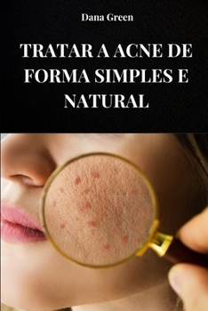 Paperback Tratar a Acne de Forma Simples E Natural: Como tratar a acne purificando nosso corpo e com remédios exclusivamente nat [Portuguese] Book