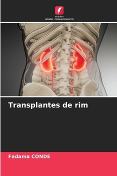 Paperback Transplantes de rim [Portuguese] Book