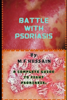 Paperback Battle with psoriasis: Complete guide to fight psoriasis Book