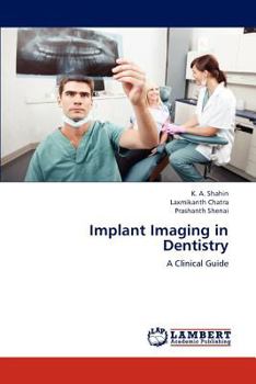 Paperback Implant Imaging in Dentistry Book