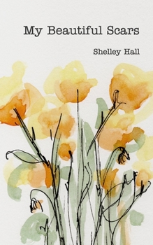 Paperback My Beautiful Scars Book