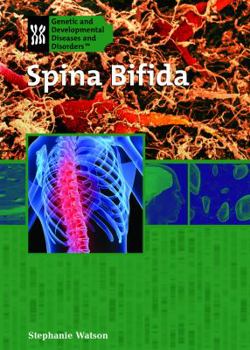 Library Binding Spina Bifida Book