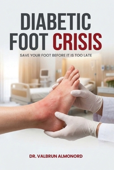 Paperback The Diabetic Foot Crisis Save Your Foot Book