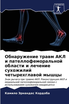 Paperback Обнаружение травм АКЛ и п [Russian] Book