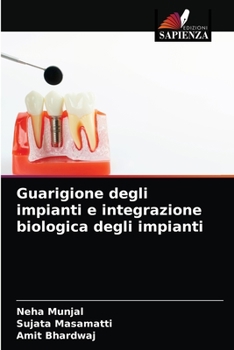 Paperback Guarigione degli impianti e integrazione biologica degli impianti [Italian] Book