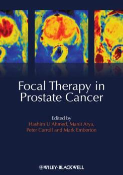 Hardcover Focal Therapy in Prostate Cancer Book