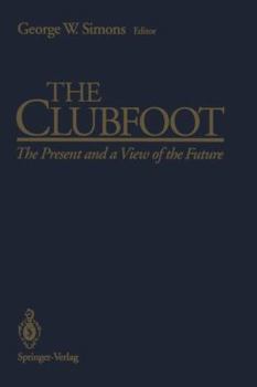 Paperback The Clubfoot: The Present and a View of the Future Book