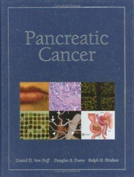 Hardcover Pancreatic Cancer Book