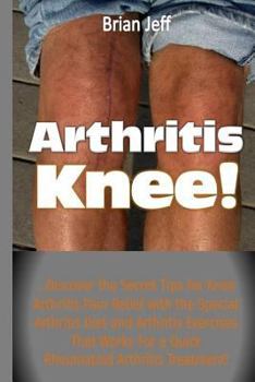 Paperback Arthritis Knee!: ...Discover the Secret Tips for Knee Arthritis Pain Relief with the Special Arthritis Diet and Arthritis Exercises Tha Book