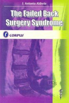 Paperback The Failed Back Surgery Syndrome Book