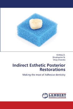 Paperback Indirect Esthetic Posterior Restorations Book