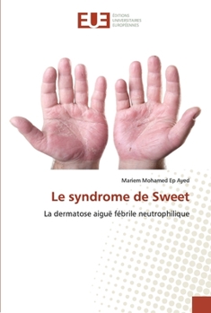 Paperback Le syndrome de Sweet [French] Book