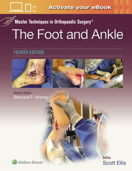 Hardcover Master Techniques in Orthopaedic Surgery: The Foot and Ankle: Print + eBook with Multimedia Book