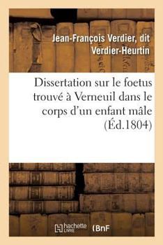 Dissertation Sur Le Foetus Trouva(c) a Verneuil Dans Le Corps D'Un Enfant Ma[le