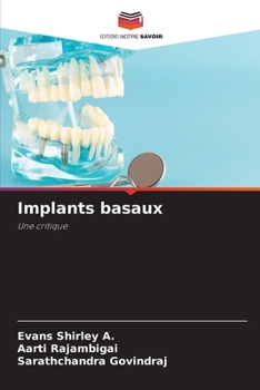 Paperback Implants basaux [French] Book