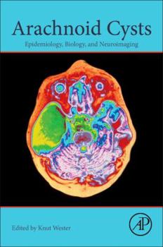 Paperback Arachnoid Cysts: Epidemiology, Biology, and Neuroimaging Book