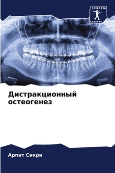 Paperback Дистракционный остеоге&# [Russian] Book