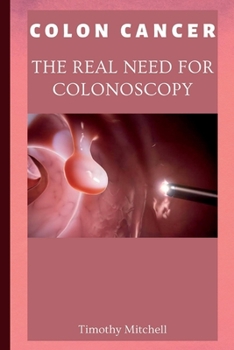Paperback Colon Cancer: The Real Need for Colonoscopy Book