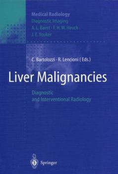 Hardcover Liver Malignancies: Diagnostic and Interventional Radiology Book