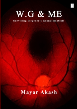 Paperback W.G & ME, Surviving Wegener's Granulomatosis: Wegener's Granulomatosis Book