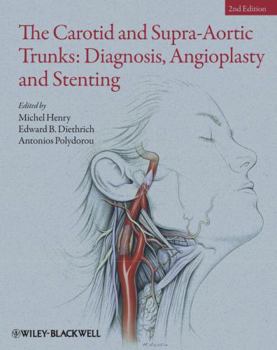 Hardcover The Carotid and Supra-Aortic Trunks: Diagnosis, Angioplasty and Stenting Book