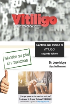 Paperback Controle Ud. mismo el Vitiligo [Spanish] Book