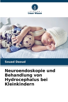 Paperback Neuroendoskopie und Behandlung von Hydrocephalus bei Kleinkindern [German] Book