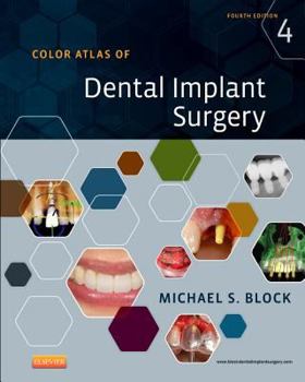 Hardcover Color Atlas of Dental Implant Surgery Book